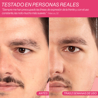 Beauty Concept Dermalift Silicone Patches Parches Reutilizables