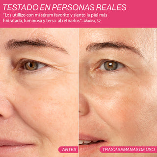 Beauty Concept Dermalift Silicone Patches Parches Reutilizables